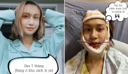 Giật mình với chi phí 'khủng' Lynk Lee phải bỏ ra để đi tìm hình hài thật của mình