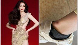 Đặng Thanh Ngân bị thương ở chân nhưng vẫn 'giấu nhẹm' fan để chinh chiến tại Miss Supranational 2023