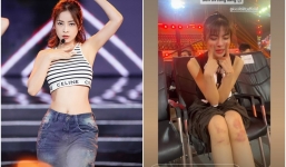 Trước giờ G chung kết Miss Grand Vietnam 2023: Lona Kiều Loan bị bầm dập, Chi Pu khoe eo thon khi tổng duyệt