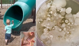 Phát hiện ra có hàng nghìn vi khuẩn trên tay của trẻ sau một giờ chơi ở công viên