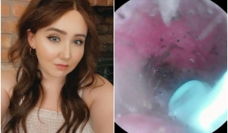 Nghe tiếng lách cách trong tai, đi khám mới phát hiện 'quái vật tám chân' làm tổ bên trong