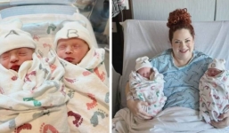 Cặp song sinh chào đời khác năm, bác sĩ đỡ đẻ khẳng định, ca sinh nở quá hiếm gặp trên thế giới