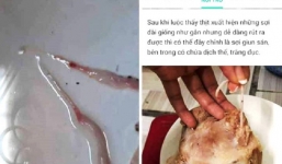 Một người phụ nữ bị phạt 10 triệu đồng vi tung tin nhiễm sán lợn