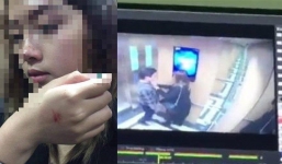 Vụ nữ sinh bị cưỡng hôn trong thang máy: Kẻ biến thái không đến xin lỗi vì ngại