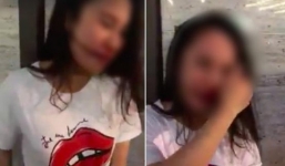 Cô gái bị lột váy đánh ghen ở Bà Triệu công khai vết thương, khẳng định oan ức