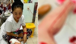 Danh hài Thúy Nga bất ngờ gặp tai nạn khiến nhiều người lo lắng