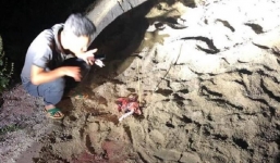 Kinh hoàng bé trai 7 tuổi bị 10 con chó lao vào cắn  ở Hưng Yên