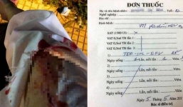 Cô gái trẻ bị kẻ lạ mặt dùng vật nhọn đâm chảy máu khi dừng đèn đỏ phải điều trị chống HIV