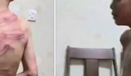 Công an Thanh Hóa xác minh vụ việc bé trai bị cha dượng đánh dã man