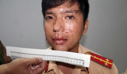 Nhóm côn đồ giả danh cảnh sát hình sự hành hung chiến sĩ công an