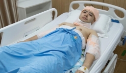 Akira Phan bất ngờ khiến người hâm mộ xôn xao khi băng bó tay, cổ và phần đầu