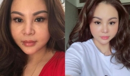 'Nữ danh hài được Hoài Linh hỏi cưới' phản ứng quyết liệt khi bị chê mặt bị biến dạng