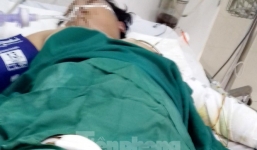 Xác định nguyên nhân ban đầu vụ chồng tưới xăng lên người vợ bầu 8 tháng 