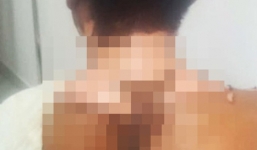 Xôn xao vụ việc nam thanh niên bị chị ruột đổ nước sôi lên người