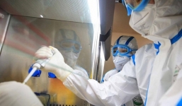 Chuyên gia khẳng định về khả năng tái nhiễm virus corona với những người đã khỏi bệnh