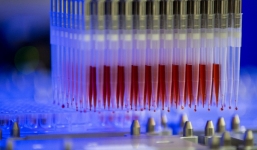 Pháp thử nghiệm lâm sàng thành công thuốc chữa Covid-19