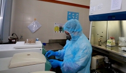 Bộ Y tế: Không cho phép xét nghiệm Covid-19 dịch vụ theo yêu cầu