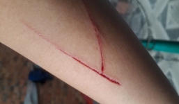 Công an TP HCM thông tin về vụ bé gái trong vụ án cưỡng hiếp bị rạch tay