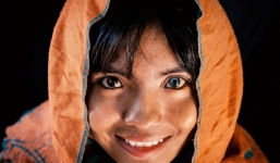 Cuộc sống hiện tại của cô gái sở hữu 2 màu mắt kỳ lạ, bất ngờ ngoại hình