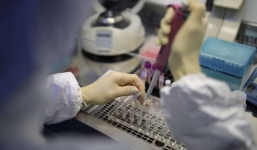 Bố của bệnh nhân 418 tử vong không liên quan đến Covid-19