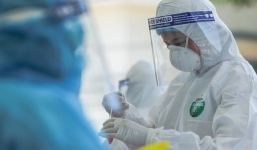 Bệnh nhân 438 mắc covid-19 đã khỏi nhưng tiên lượng vẫn rất nặng