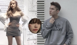 Đang yên đang lành, bạn gái tin đồn của Sơn Tùng lộ ảnh bị đánh bầm dập trên mặt khiến fan hoang mang