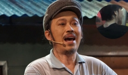 Hoài Linh vô tình để lộ 'bí mật' giấu kín trên cơ thể khiến dân tình bất ngờ