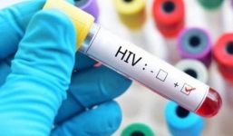 Người thứ 2 trên thế giới được chữa khỏi HIV bằng liệu pháp tế bào gốc