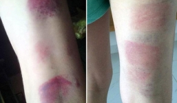 Tạm đình chỉ cô giáo bạo hành 22 học sinh ở Vũng Tàu