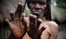 Kỳ lạ bộ tộc phụ nữ phải cắt đốt ngón tay khi người thân qua đời