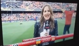 Nữ phóng viên bị cầu thủ Arsenal sút bóng vào đầu trên sóng trực tiếp