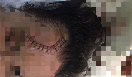 Truy tìm ô tô Mazda CX5 đâm trọng thương cô gái rồi bỏ chạy