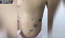 Bác tra tấn cháu ruột như thời Trung cổ gây chấn động nước Nga