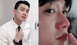 Quốc Trường đáp trả khôn khéo trước nghi án phẫu thuật mũi