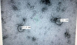 Việt Nam nuôi cấy và phân lập thành công virus corona giữa đại dịch