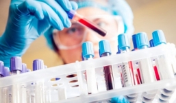 Thực hư thông tin dịch vụ xét nghiệm virus corona tại nhà