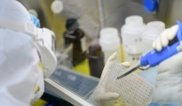 Bất ngờ về cơ chế gây tử vong của virus corona