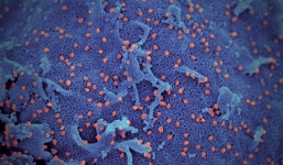 Cận cảnh hình chụp virus corona dưới kính hiển vi