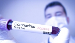 15 lầm tưởng cực tai hại về dịch virus corona nhiều người mắc phải