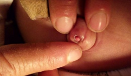 Bé sơ sinh gặp nguy hiểm, bác sĩ mới phát hiện sự thật kinh khủng 