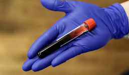 Vắc xin chống Covid-19 được đưa vào thử nghiệm tại Mỹ