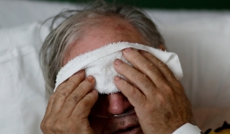 Lý giải lý do bị mất khứu giác khi nhiễm Covid-19