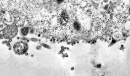 Cận cảnh thời điểm virus corona xâm nhập tế bào khoẻ mạnh