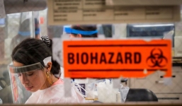 Phát hiện triệu chứng quan trọng nhất của Covid-19 ở thể nặng