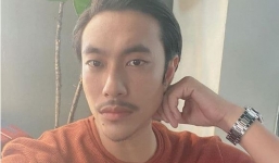 Kiều Minh Tuấn gây hoang mang với gương mặt 'biến dạng' vì chỉnh sửa 'quá tay'