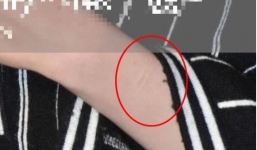 Dương Mịch dính tin đồn ngược đãi bản thân khi hớ hênh lộ sẹo ở cổ tay