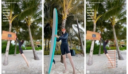 Mỹ nhân được siêu xe Đặng Lê Nguyên Vũ hộ tống lộ đôi chân 'biến dạng' khó tin