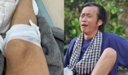 Hoài Linh gặp tai nạn hy hữu, người hâm mộ lo lắng