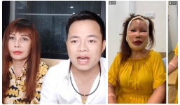 Cô dâu 62 tuổi ở Cao Bằng lộ khuôn mặt khiến ai cũng câm nín hậu phẫu thuật