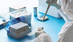 Chi phí xét nghiệm Covid-19 đối với người có thẻ BHYT